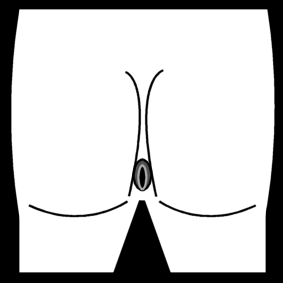 buttocks / anus