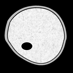 ovum